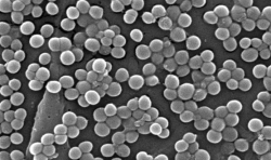 Marc Emery has a dangerous superbug called MRSA (pictured here magnified) but is feeling healthy.